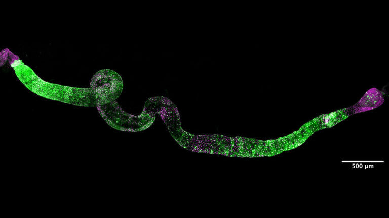 fruit fly intestine