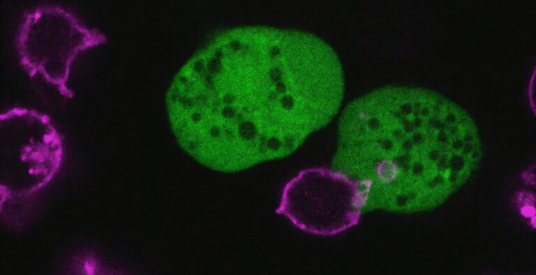 Entamoeba histolytica